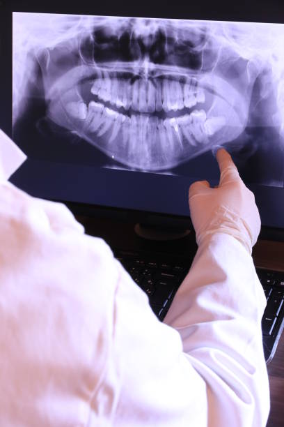 Best Emergency Dental Care for Broken or Chipped Teeth in Hanna City, IL