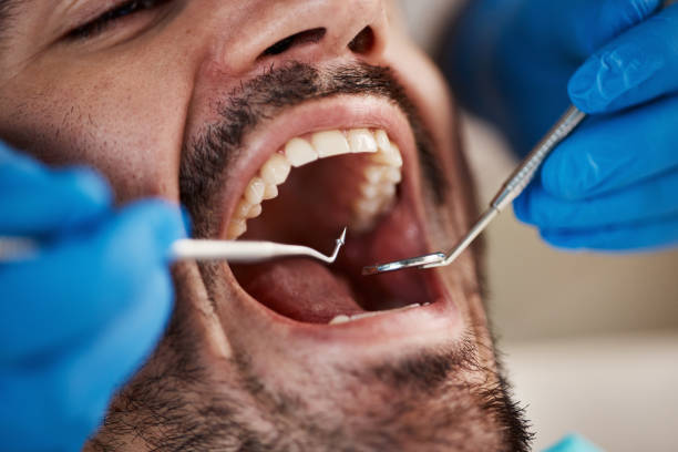 Best Emergency Denture Repair in Hanna City, IL
